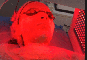 نمونه پاکسازی پوست کلینیک گلدن رویال