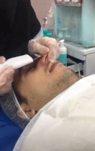 نمونه پاکسازی پوست کلینیک زیبایی بهاران