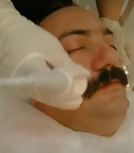 نمونه پاکسازی پوست کلینیک زیبایی دلوین