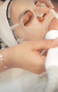 نمونه پاکسازی پوست کلینیک زیبایی دلوین