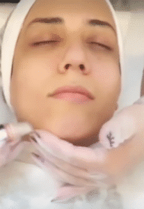 نمونه پاکسازی پوست کلینیک زیبایی دلوین