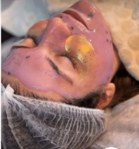 نمونه پاکسازی پوست کلینیک زیبایی دلوین