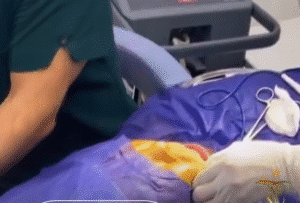 نمونه عمل بوکال فت دکتر حسن طالب زاده