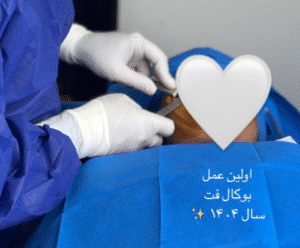 نمونه عمل بوکال فت کلینیک زیبایی آرمان