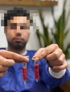 نمونه عمل بوکال فت کلینیک زیبایی آرمان