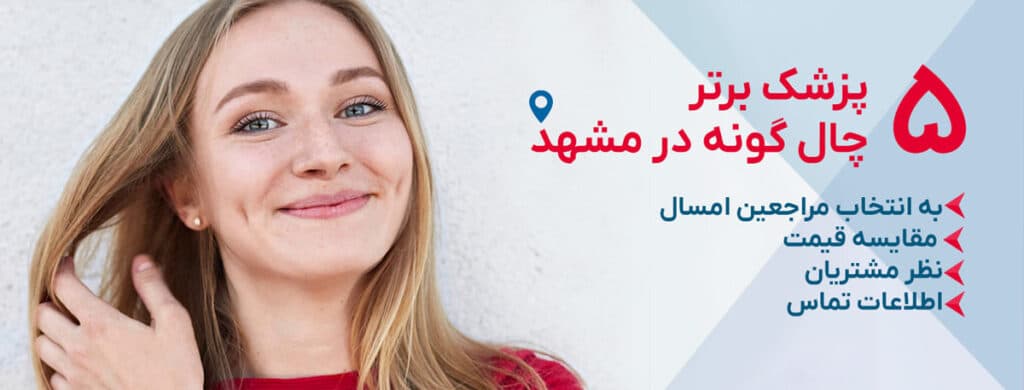 بهترین دکتر عمل چال گونه در مشهد