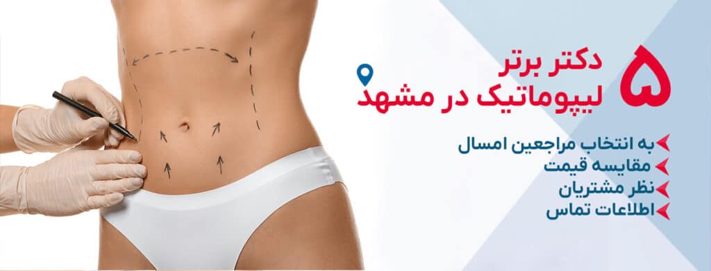 بهترین دکتر لیپوماتیک در مشهد