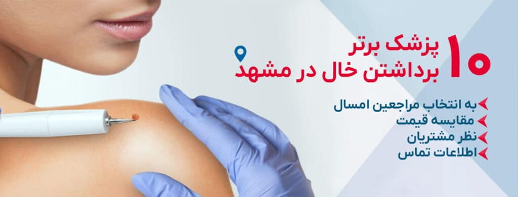بهترین دکتر برداشتن خال در مشهد