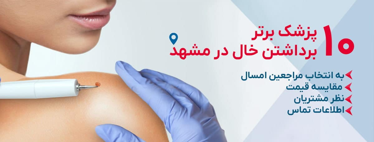 بهترین دکتر برداشتن خال در مشهد