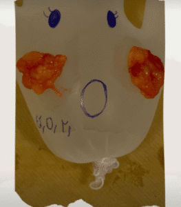 نمونه عمل بوکال فت کلینیک زیبایی سمن