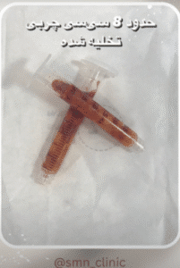 نمونه عمل بوکال فت کلینیک زیبایی سمن