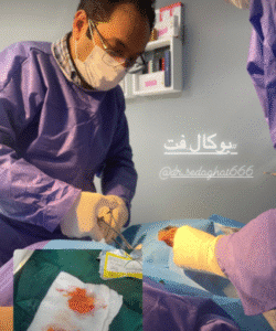 نمونه جراحی بوکال فت دکتر توحید صداقت