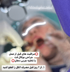 نمونه جراحی بوکال فت دکتر توحید صداقت