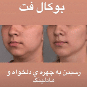 نمونه جراحی بوکال فت دکتر توحید صداقت