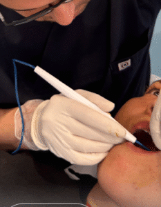 نمونه جراحی بوکال فت دکتر رضا قندهاری (کلینیک زیبایی ماهان)