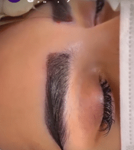 نمونه کاشت ابرو کلینیک زیبایی ماهان