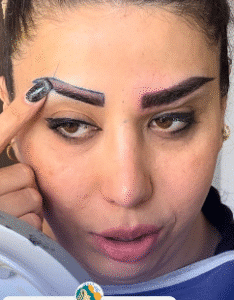 نمونه کاشت ابرو کلینیک زیبایی ماهان