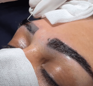 نمونه کاشت ابرو کلینیک زیبایی ماهان