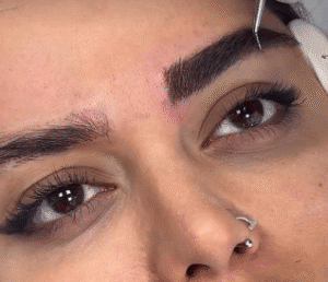 نمونه کاشت ابرو کلینیک زیبایی ماهان