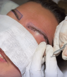 نمونه کاشت ابرو کلینیک زیبایی ماهان