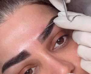 نمونه کاشت ابرو کلینیک زیبایی ماهان