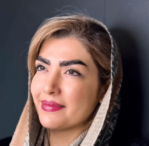 نمونه کاشت ابرو کلینیک باران توس