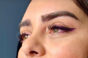 نمونه کاشت ابرو کلینیک باران توس