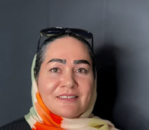 نمونه کاشت ابرو کلینیک باران توس