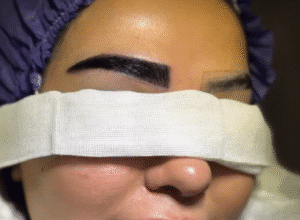 نمونه کاشت ابرو کلینیک باران توس