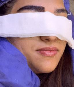 نمونه کاشت ابرو کلینیک باران توس