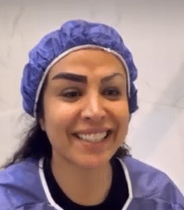 نمونه کاشت ابرو کلینیک باران توس