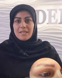 نمونه کاشت ابرو کلینیک زیبایی دنیز