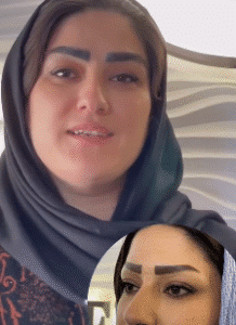 نمونه کاشت ابرو کلینیک زیبایی دنیز