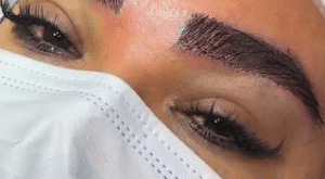 نمونه کاشت ابرو کلینیک زیبایی دنیز