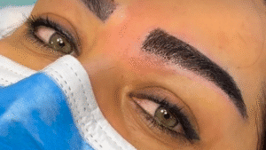 نمونه کاشت ابرو کلینیک زیبایی دنیز