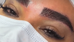 نمونه کاشت ابرو کلینیک زیبایی دنیز