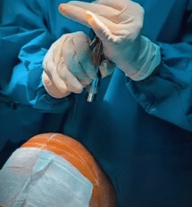 کاشت مو کلینیک سلامت ایده آل