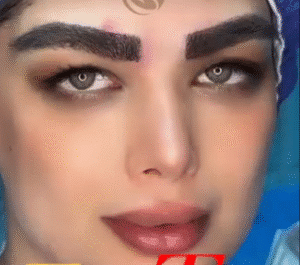 کاشت ابرو کلینیک سلامت ایده آل