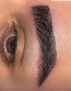 نمونه کاشت ابرو کلینیک زیبایی آبنوس