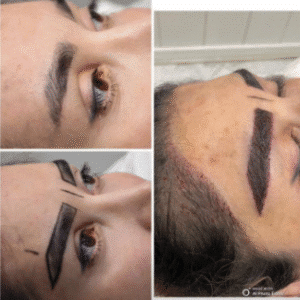 نمونه کاشت ابرو کلینیک زیبایی آبنوس