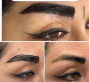 نمونه کاشت ابرو کلینیک زیبایی آبنوس