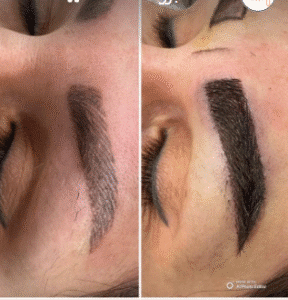 نمونه کاشت ابرو کلینیک زیبایی آبنوس