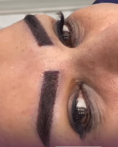 نمونه کاشت ابرو کلینیک زیبایی آبنوس