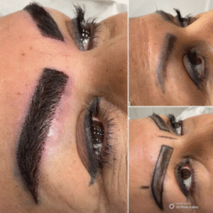 نمونه کاشت ابرو کلینیک زیبایی آبنوس
