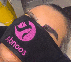 نمونه کاشت ابرو کلینیک زیبایی آبنوس