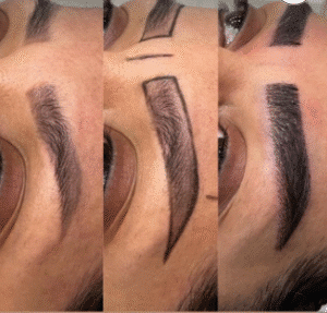 نمونه کاشت ابرو کلینیک زیبایی آبنوس