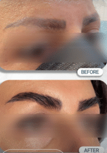 نمونه کاشت ابرو کلینیک زیبایی مریم