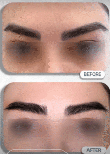 نمونه کاشت ابرو کلینیک زیبایی مریم