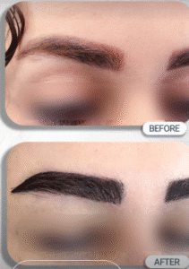 نمونه کاشت ابرو کلینیک زیبایی مریم