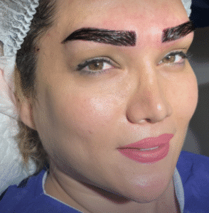 نمونه کاشت ابرو کلینیک زیبایی مریم